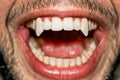 Sharp vampire teeth Royalty Free Stock Photo