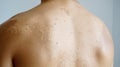 shed skin from sunburn Royalty Free Stock Photo