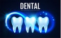 Shining Helthy Tooth with Motion Lights. Cleaining Teeth. Frech Stomatology Design Template. Dental Enamel Health