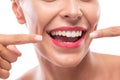 Shining white teeth and a beautiful smile Royalty Free Stock Photo