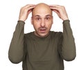 Shocked bald man isolated on white. Hair loss Royalty Free Stock Photo