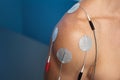 Shoulder Electrical Stimulation / TENS Royalty Free Stock Photo