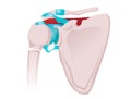 Shoulder fracture vector illustration. Illustration of the neck of humerus fracrture