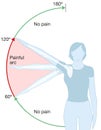 Shoulder impingement. Painful arc. Labeled illustration