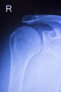 Shoulder joint orthopedic xray scan Royalty Free Stock Photo