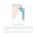 Shoulder joint replacement