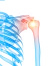 The shoulder joint showing pain