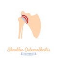 Shoulder osteoarthritis icon