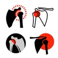 Shoulder osteoarthritis icon