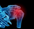 shoulder pain illustration CT image Royalty Free Stock Photo