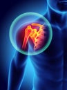 Shoulder painful skeleton x-ray, 3D illustration. Royalty Free Stock Photo