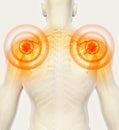 Shoulder painful skeleton x-ray, 3D illustration. Royalty Free Stock Photo