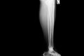 Show image of tibia and fibula left lateral