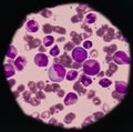 Showing abnormal cells.