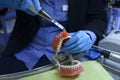 Showing way of dental treatment. WomanÃ¢â¬â¢s hand in blue gloves shining on the typodont, plastic moulage of human jaws and teeth,