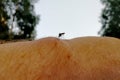 The Siberian mosquito sits on the human body and wants to bite.