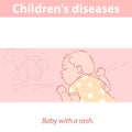 Little baby with rash on face and body. Royalty Free Stock Photo