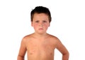 Sick boy child 2 Royalty Free Stock Photo