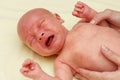 Sick newborn child with alergy rash is weeping