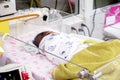 A sick newborn with respiratory problems sleeping on the baby bed and wear the oxygen box