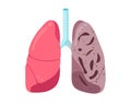 Sick unhealthy lungs tuberculosis infection disease. Human respiratory system internal organ tubercle bacillus infected