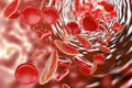 Sickle cell anemia