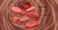 Sickle cell anemia, rbcs in flow in 3d illustration Royalty Free Stock Photo