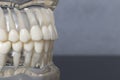 Side close up view of teeth model Royalty Free Stock Photo