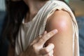 Side effect of the vaccine - shoulder skin redness and pain. Covid-19 vaccination reaction. Woman skin itchy and