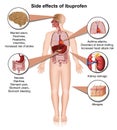 Side effects of ibuprofen 3d medical illustration on white background