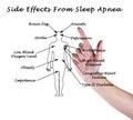 Side Effects From Sleep Apnea Royalty Free Stock Photo