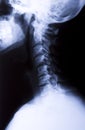 Side Neck X-Ray Royalty Free Stock Photo