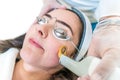 Side view of laser treatment for skin redness, to rejuvenate skin. Using the Excel V laser by Cutera, with a gold ring on the hand Royalty Free Stock Photo