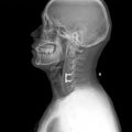 Side X-ray picture of head and neck Royalty Free Stock Photo