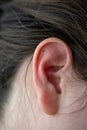 A sideways portrait of the ear of a woman with acupressure ear seeds in it. The three metal balls are a form of alternative
