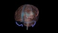 The sigmoid sinus is a paired intracranial venous channel