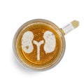 Sign kidney on the beer foam in glass isolated on white background. Top view. Harm of alcohol concept