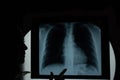 Post anterior chest X-ray showing lung parenchyma homogeneous radiographic pattern and aortic button prominence reviewing by