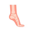 Silhouette human foot with bones, orthopedic leg, healthy feet. Foot deformation, defect, pathologies of foot, flat foot