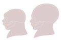 Silhouette image of the head and skull of a newborn child with a normal cranium and with microcephaly and severe microcephaly. Royalty Free Stock Photo