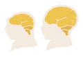 Silhouette image of the head and skull of a newborn child with a normal cranium and with microcephaly and severe microcephaly.