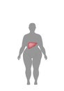 A silhouette of a man with excessive weight is drawn a liver. vector illustration.