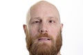 Silly bald man with red beard and crossed eyes Royalty Free Stock Photo