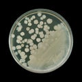 Similar light beige bacterial colonies on a petri dish isolated on a black background