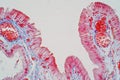 simple columnar epithelium is a columnar epithelium that is uni-layered. In humans,