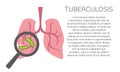 Simple, flat illustration of a lung disease. Pneumonia infographics, drawing for informational, medical poster