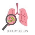 Simple, flat illustration of a lung disease. Pneumonia infographics, drawing for informational, medical poster