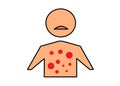 A simple shape of a human body upper torso with red dots indicating rashes and sensitive skin