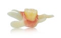 Single artificial denture - false tooth - elastic prosthesis
