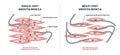 Single unit vs multi unit smooth muscle structure differences outline diagram Royalty Free Stock Photo